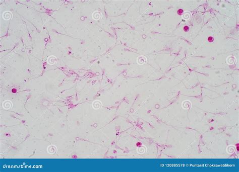 Sperm Morphology. Semen Photo Under Microscope | CartoonDealer.com ...