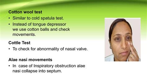 Examination of nose | PPTX