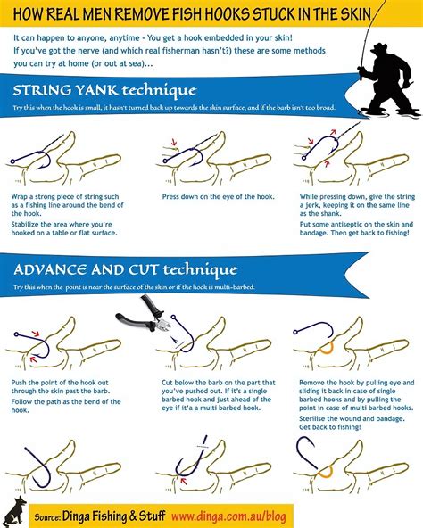 Image result for String Yank Method