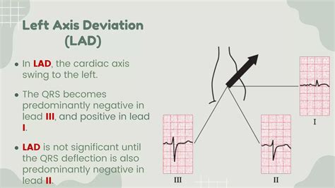 Cardiac Axis Simplified.pptx