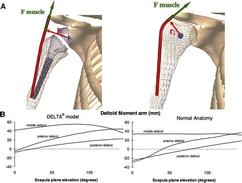 History Of Reverse Total Shoulder Arthroplasty at Guadalupe Harshaw blog