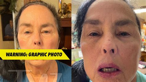 'Duck Dynasty' Star Kay Robertson Healing Nicely After Dog Bite ...