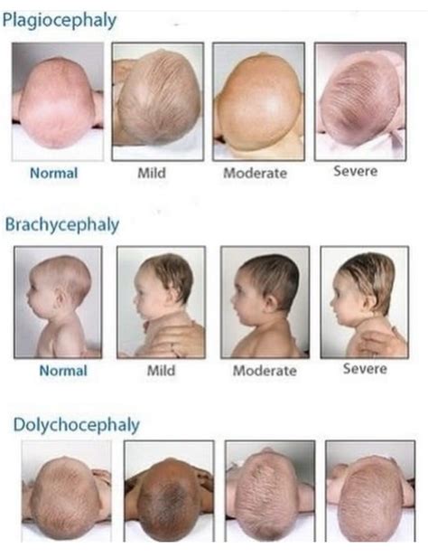 Pin by Laura Guest on Nurses & Medics - Serious Stuff | Baby facts ...