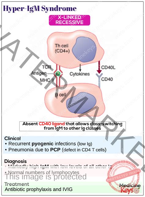 Hyper-IgM syndrome - Medicine Keys for MRCPs