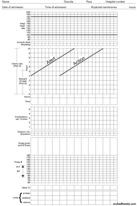 Image result for Partogram Examples