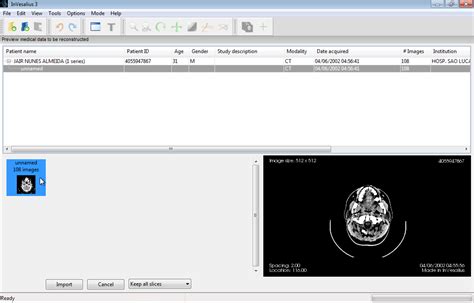 InVesalius Tutorial 的图像结果