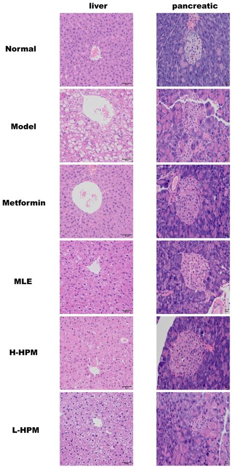 High-Protein Mulberry Leaves Improve Glucose and Lipid Metabolism via ...