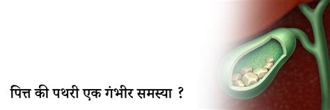 पित्ताशय की पथरी: कारण, लक्षण, जटिलताएँ और इलाज के प्रभावी उपाय ...