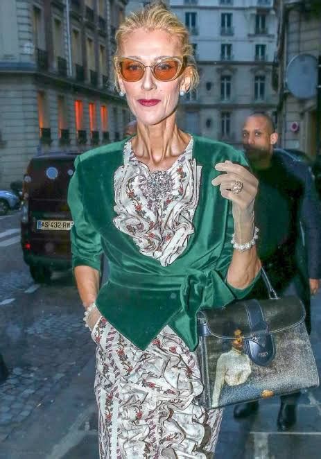See The Incurable Disease Celine Dion is Suffering From That Has Left ...