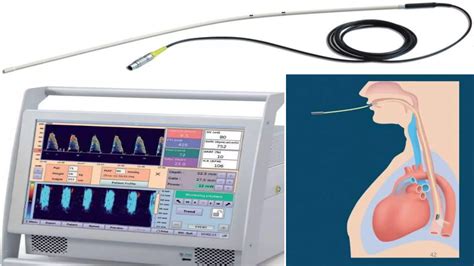 Image result for Testing Cardiac Monitor Output
