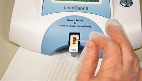 Providing lead testing for children in Richmond County - The Augusta Press