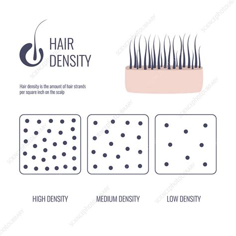 Normal Hair Density 的图像结果