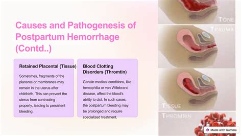 Postpartum-Hemorrhage.pptx