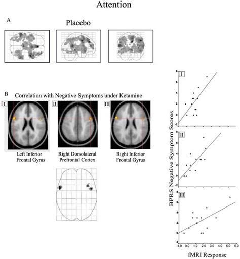 Continuous Performance Task 的图像结果