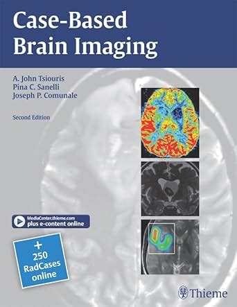 Case-Based Brain Imaging eBook : Tsiouris, A. John, Sanelli, Pina C ...