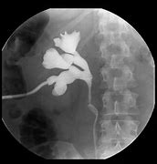 Image result for nephrostoma