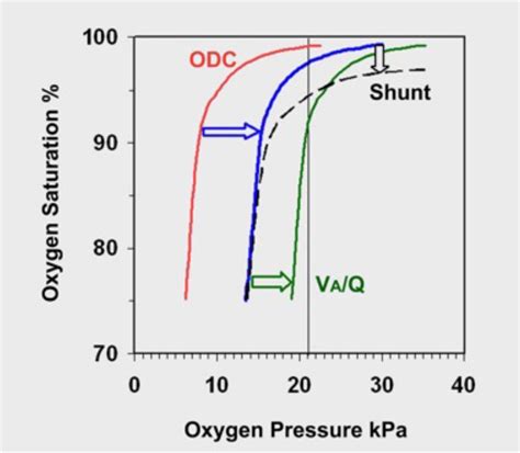 Image result for PaO2 SpO2