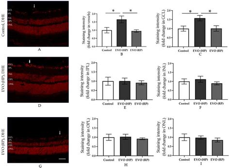 Intraocular Pressure-Induced Endothelial Dysfunction of Retinal Blood ...