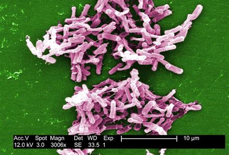 Image result for Dead Pathogen