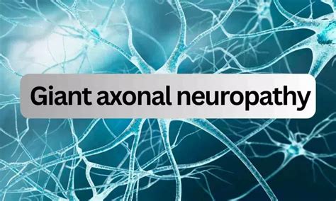 Experimental gene therapy for giant axonal neuropathy promising in ...