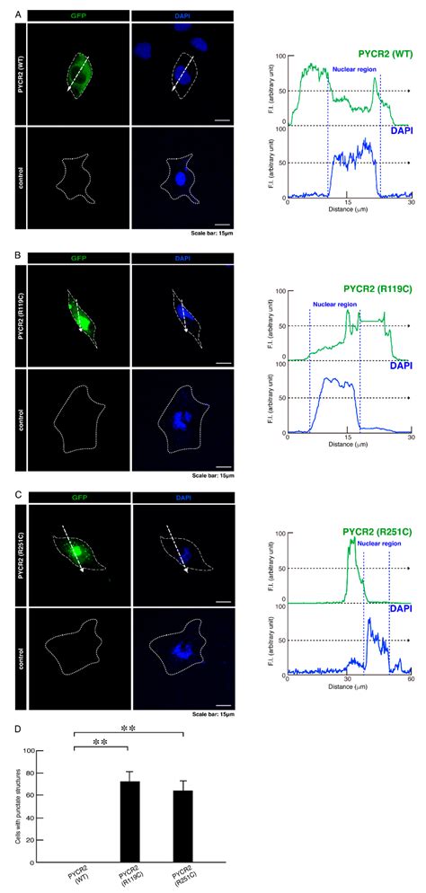 Hypomyelinating Leukodystrophy 10 (HLD10)-Associated Mutations of PYCR2 ...