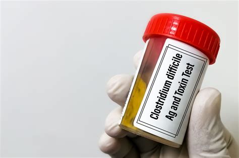 Clinicians Should Monitor Diarrhea As Symptom of C. difficile Infection ...