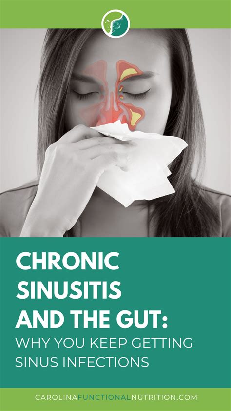 Do Antibiotics Clear Up Sinus Infections at Elizabeth Ogilvy blog
