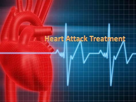 Heart Attack Treatment | PPTX