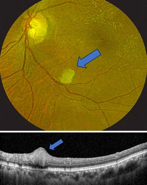 Navigate the Retinal Landscape with Confidence