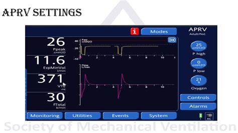 APRV Mode Explained 的图像结果