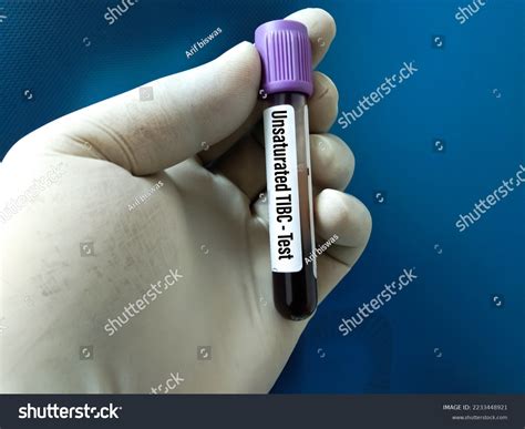 75 Blood Plasma Binding Images, Stock Photos & Vectors | Shutterstock