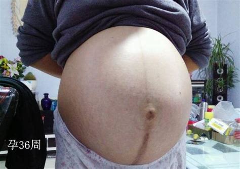 怀孕36周，为什么胎儿的胎动还是特别多？多半跟3个原因有关
