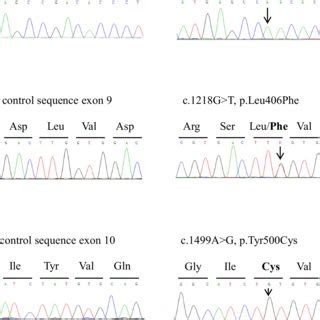 Electropherogram Interpretation 的图像结果