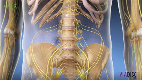 Image result for Via Disc Procedure