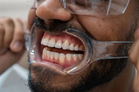 Warning Signs to Look Out for After Having Cosmetic Dentistry - Smile ...