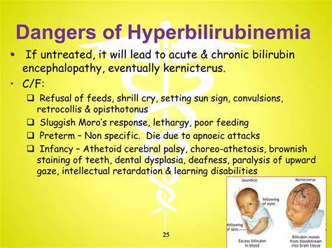 Neonatal jaundice(reference msia cpg) | PPTX