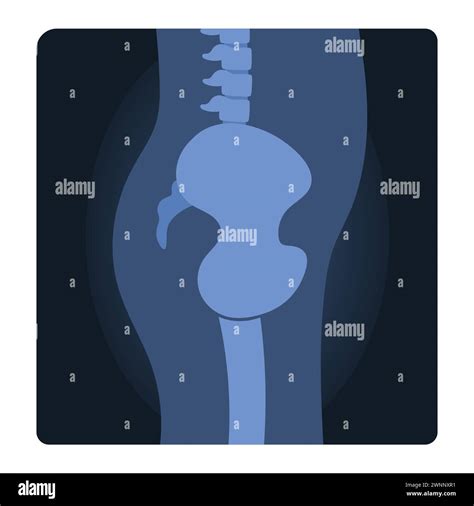 Xray shot of human body. Medical skeleton test, body radiography cartoon vector illustration ...