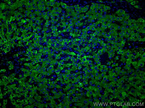 RBP4 antibody (66104-1-Ig) | Proteintech
