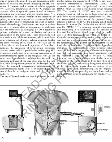 Image result for HIPEC Machine