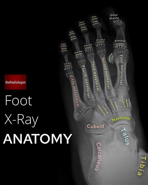 Pin by Jennifer Zuberbier on Athletic Training | Medical radiography, Radiology student, Medical ...