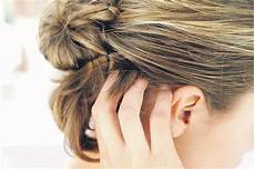 Home Remedies Hair Dye by 6 Home Remedies For Hair Dye Allergies Home Remedies For Home Remedies Hair Dye