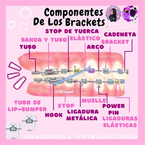 Componentes de los brackets🦷 | Ortodoncia, Odontología, Ortodoncia brackets