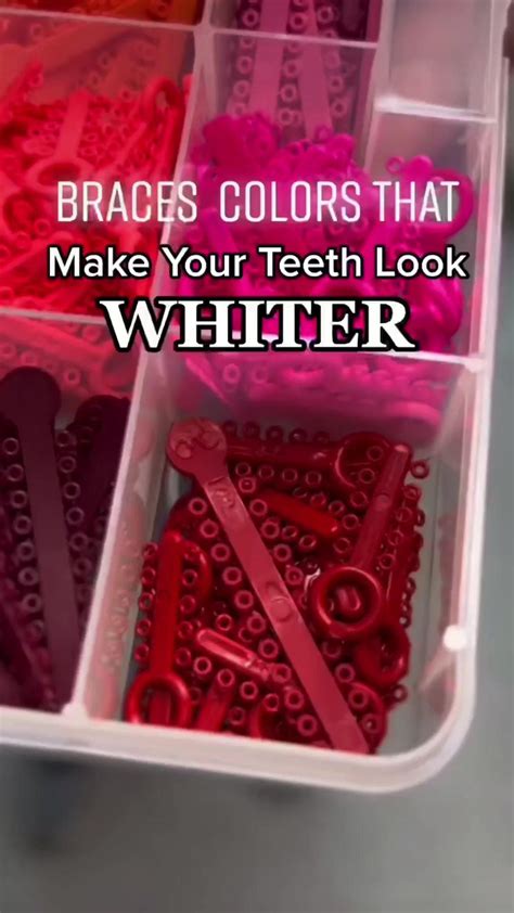 2023 braces color combos – Artofit