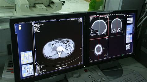 Image result for Alien Brainwave Electric Tubes