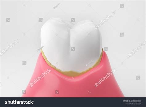 Stain Removal Teeth: Over 107 Royalty-Free Licensable Stock Illustrations & Drawings | Shutterstock