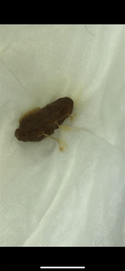 Yellow Mucus In Stool