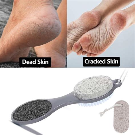 Pumice Stone for Feet with a Stone Foot Scrubber Pumice Stone Foot Scraper Set Pumice Stick ...