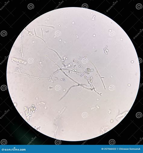 Candida In Urine