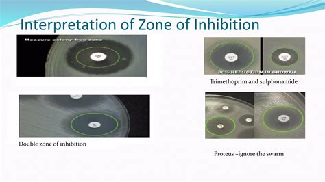 Antibiotic sensitivity testing | PPTX