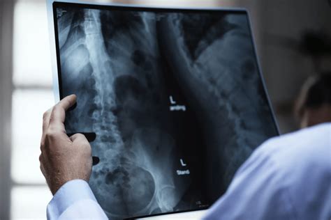 Modern applications of X-rays in medicine